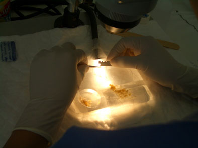 The preparation of the grafts under the microscope